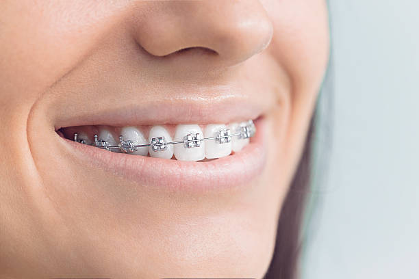 Best Invisalign and Clear Aligners  in Poseyville, IN